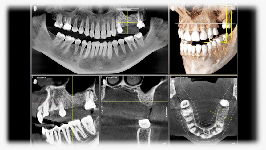 radiologia-maxilofacial