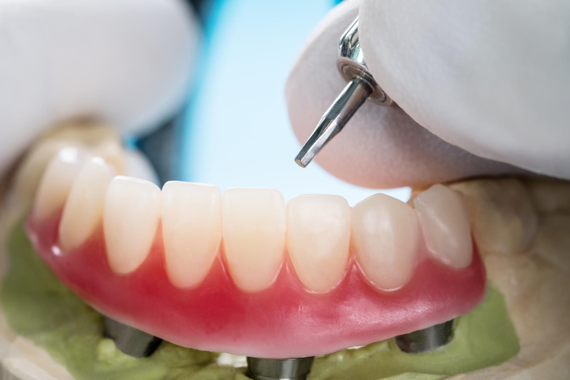 Close up Process Implants teeth health care on white background.