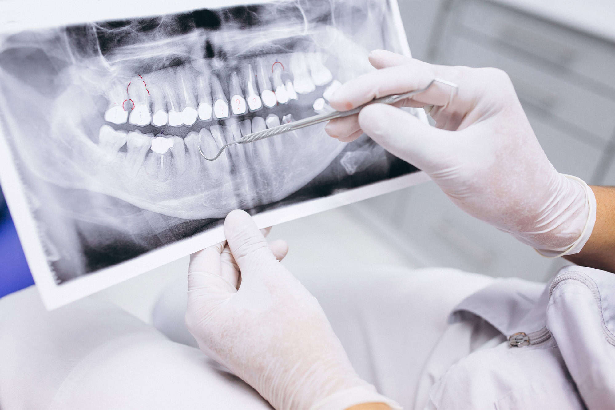 Close up Process Implants teeth health care on white background.