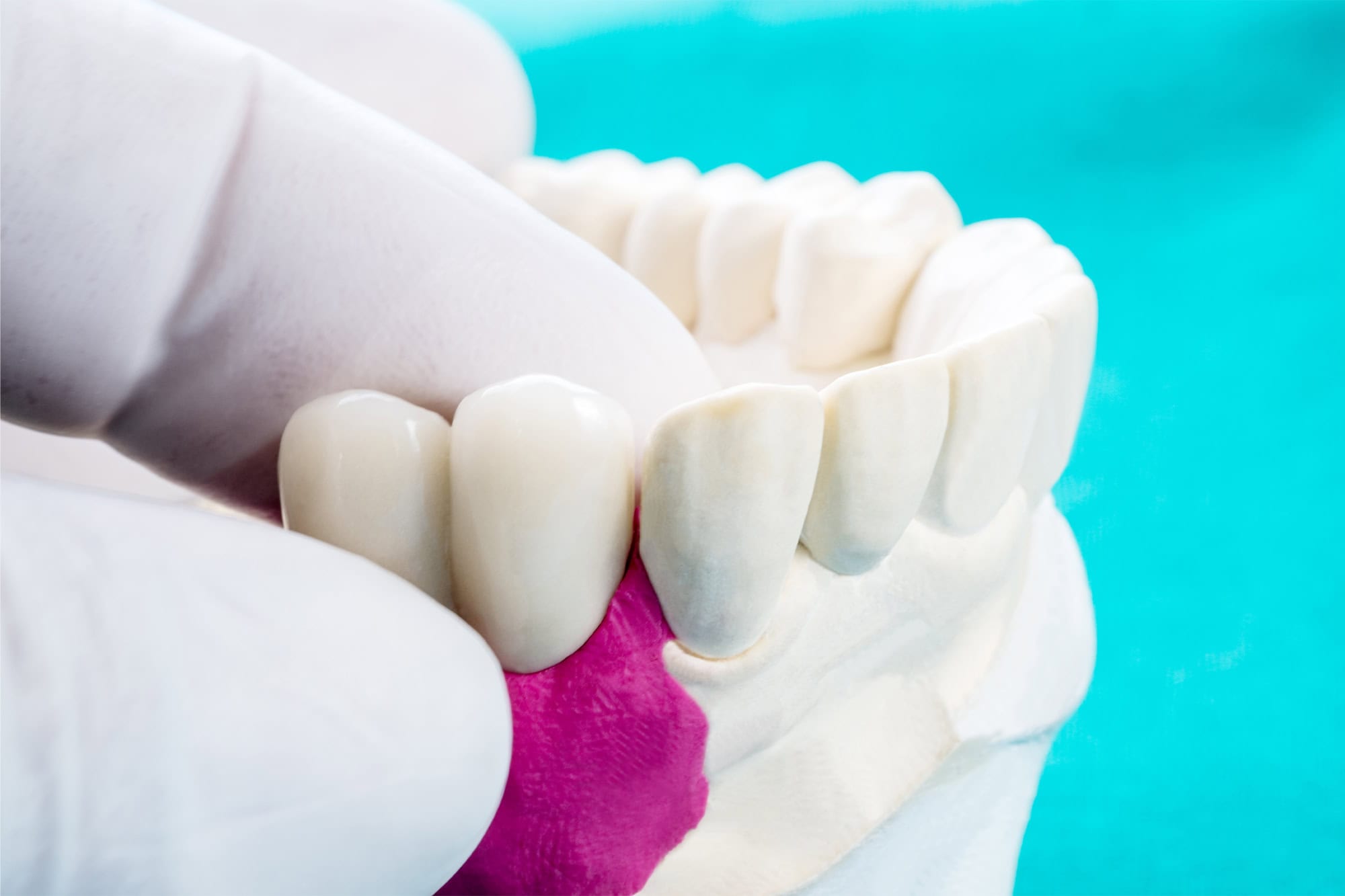 Close up Process Implants teeth health care on white background.