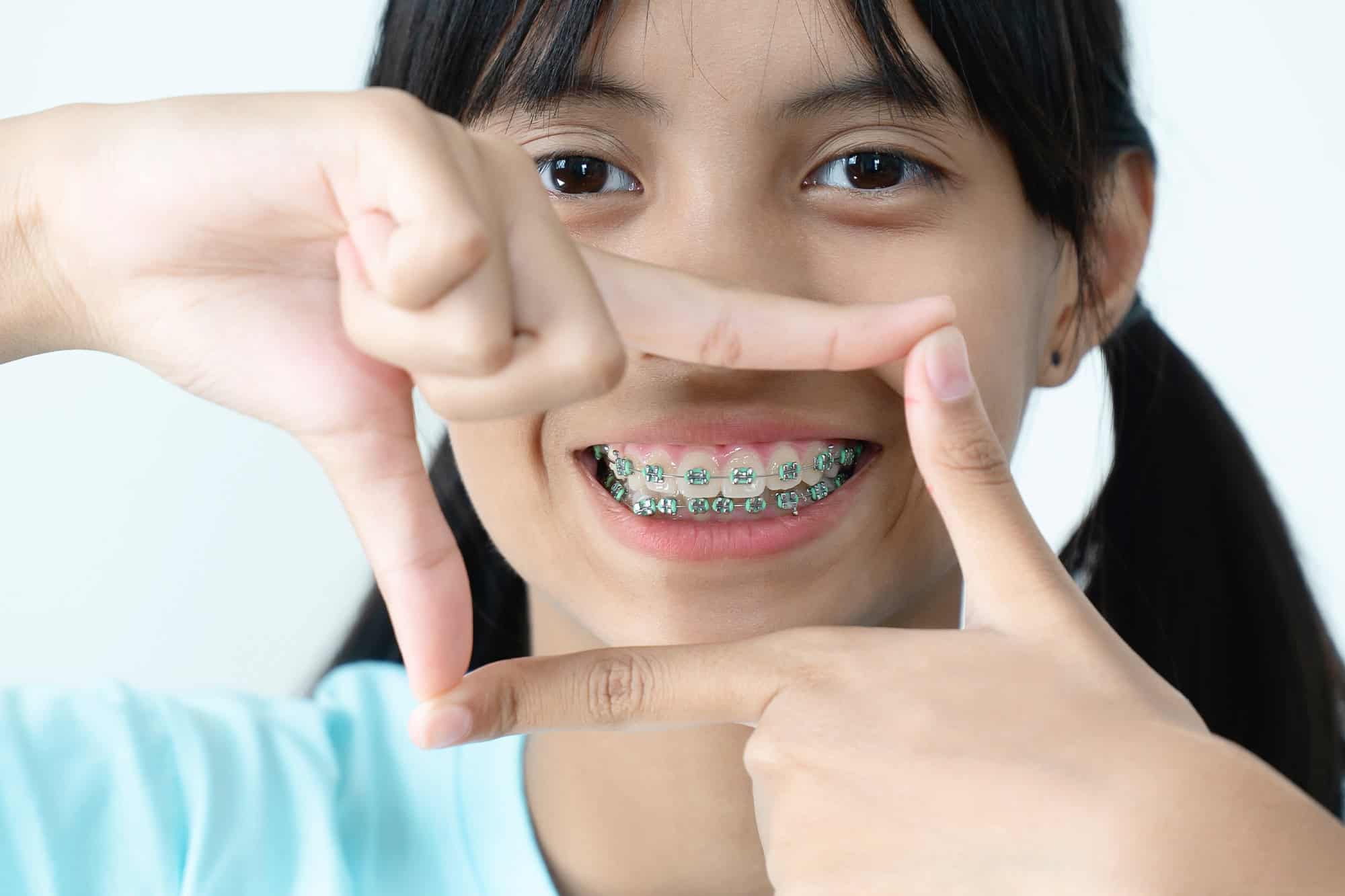 Close up Process Implants teeth health care on white background.